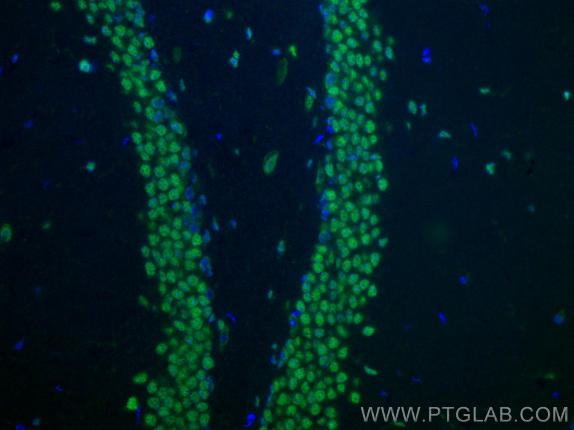 Immunofluorescence (IF) / fluorescent staining of mouse brain tissue using CoraLite® Plus 488-conjugated BRN2 Polyclonal anti (CL488-14596)