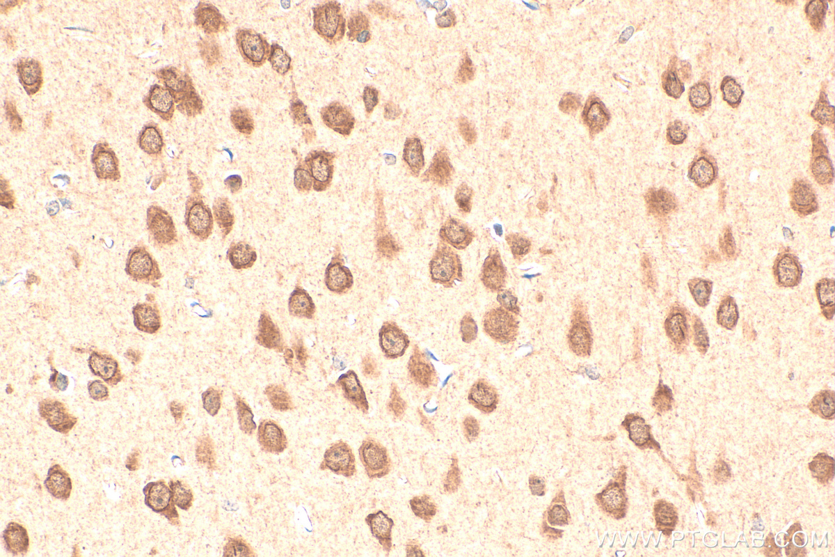 Immunohistochemistry (IHC) staining of rat brain tissue using BRUNOL5 Polyclonal antibody (13557-1-AP)