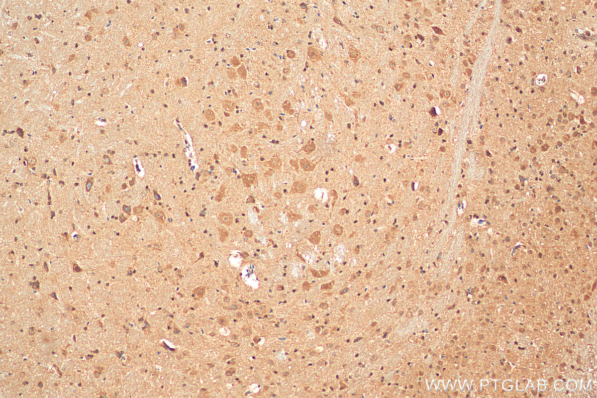 Immunohistochemistry (IHC) staining of mouse cerebellum tissue using BRWD1 Polyclonal antibody (29293-1-AP)