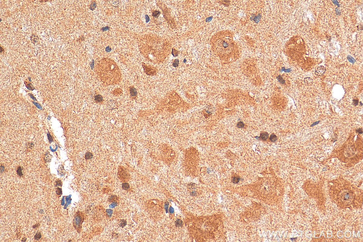 Immunohistochemistry (IHC) staining of mouse cerebellum tissue using BRWD1 Polyclonal antibody (29293-1-AP)