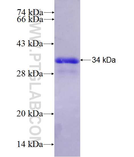 BRWD2 fusion protein Ag28085 SDS-PAGE