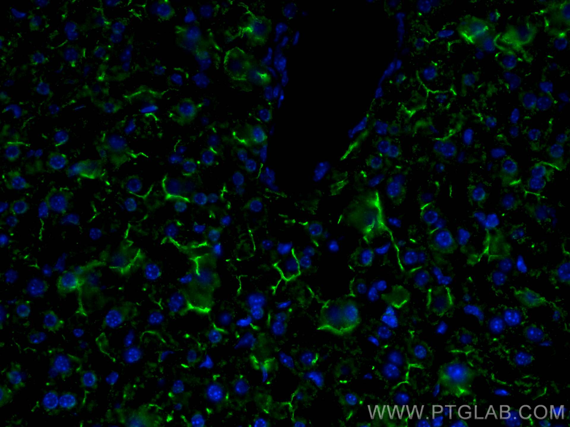 Immunofluorescence (IF) / fluorescent staining of mouse liver tissue using BSEP Monoclonal antibody (67512-1-Ig)