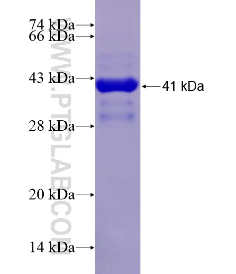 BSEP fusion protein Ag29121 SDS-PAGE