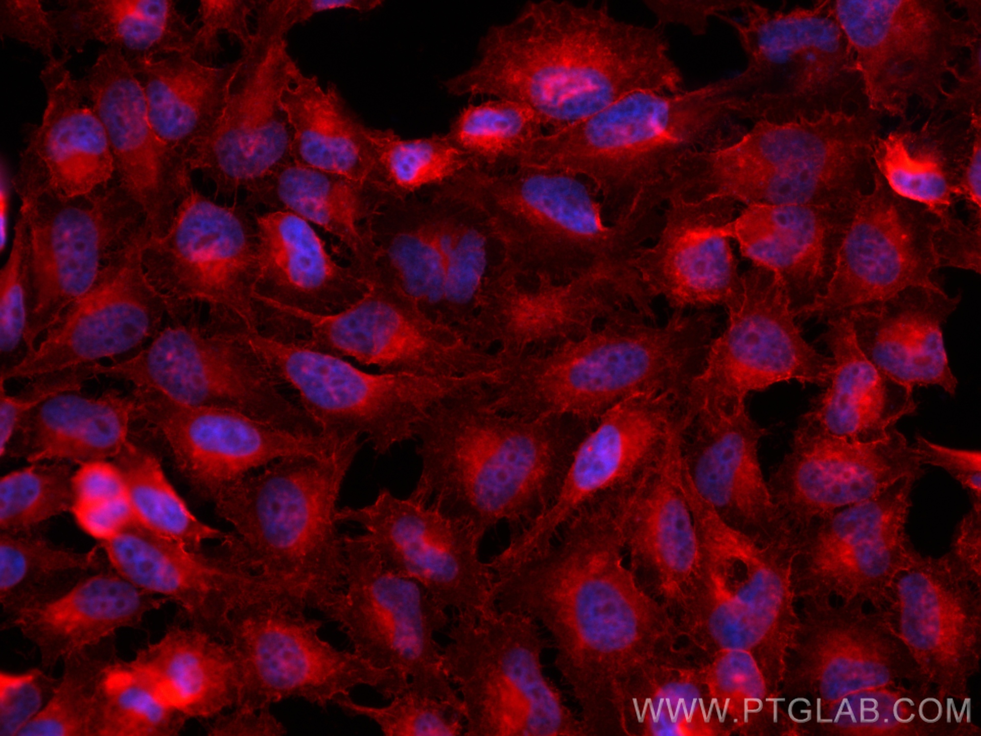 Immunofluorescence (IF) / fluorescent staining of HeLa cells using CD147 Polyclonal antibody (11989-1-AP)