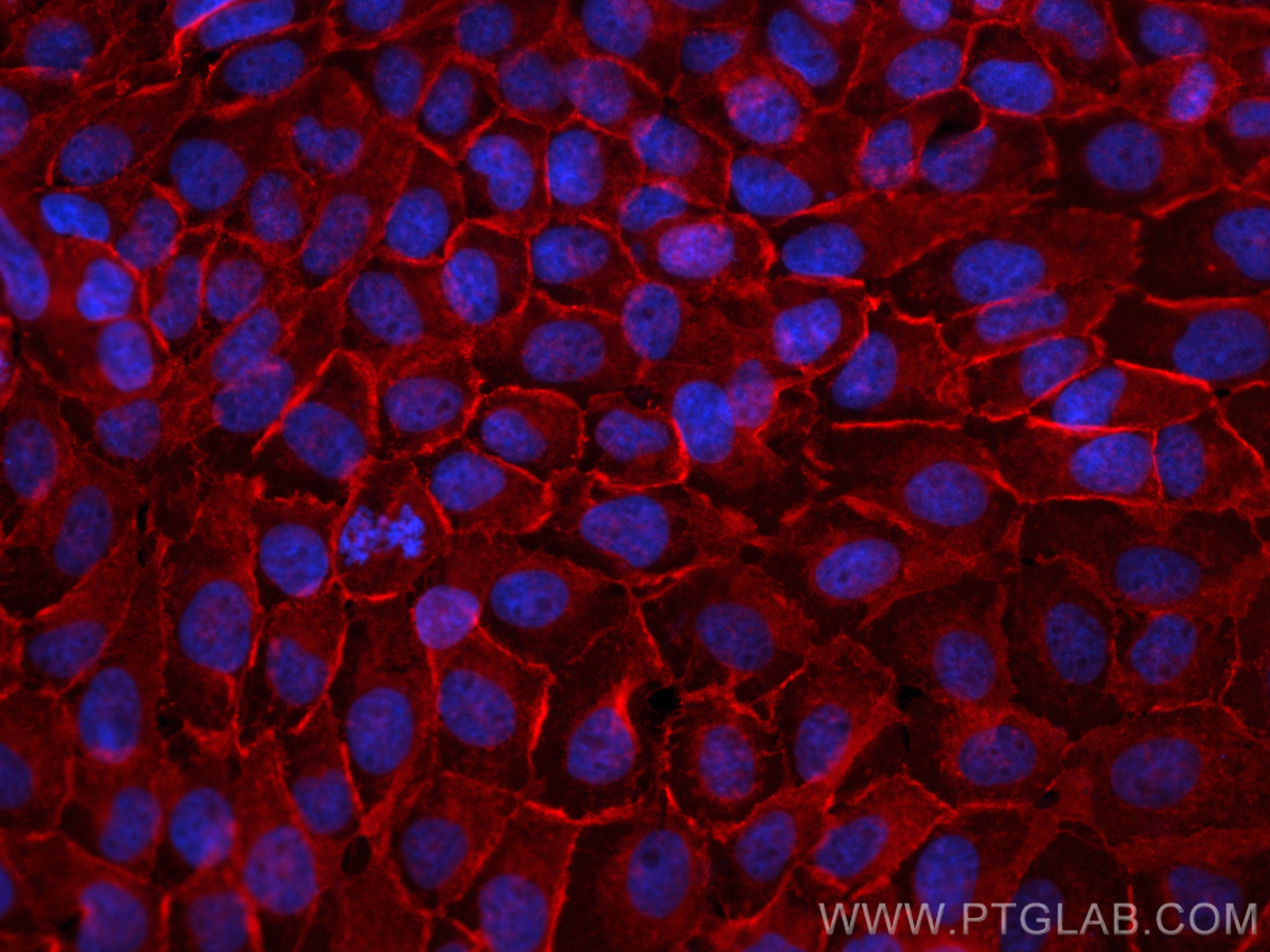 Immunofluorescence (IF) / fluorescent staining of A431 cells using CD147 Polyclonal antibody (11989-1-AP)