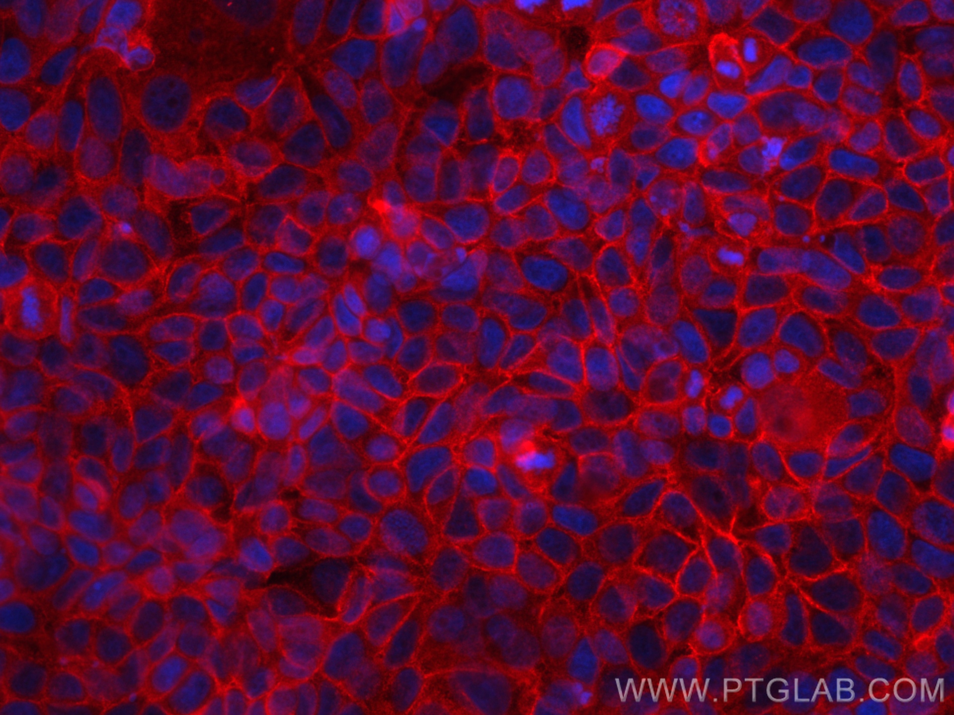 Immunofluorescence (IF) / fluorescent staining of MCF-7 cells using CD147 Polyclonal antibody (11989-1-AP)