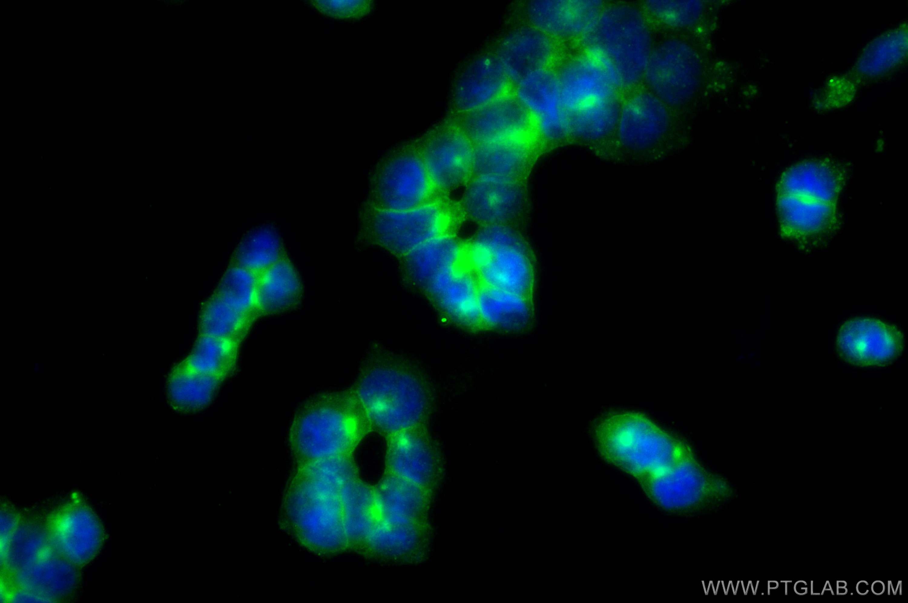 Immunofluorescence (IF) / fluorescent staining of NCCIT cells using BST2 Polyclonal antibody (13560-1-AP)