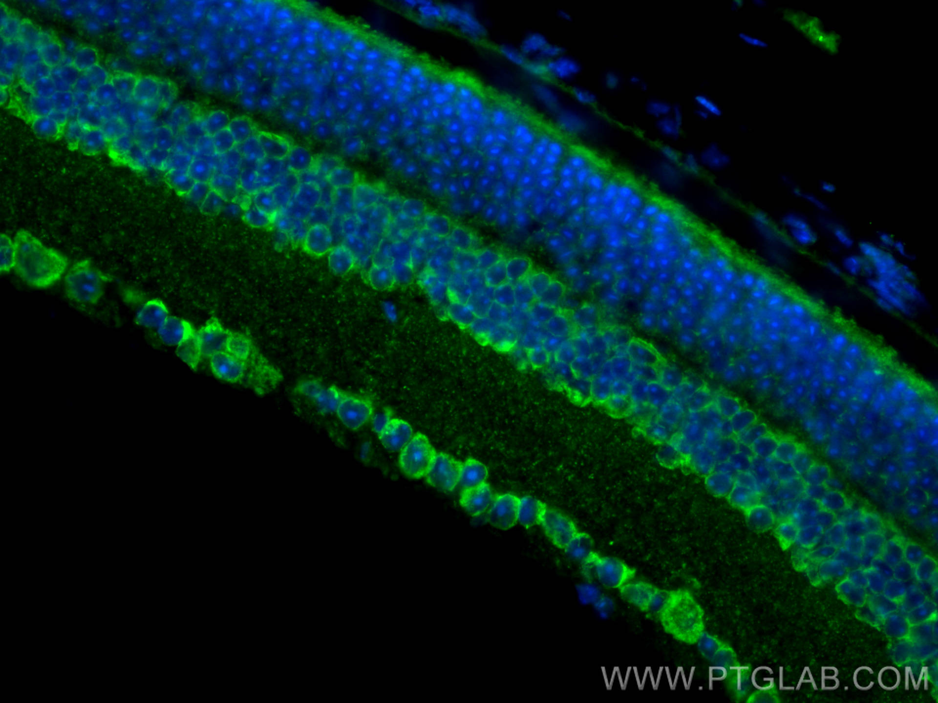 Immunofluorescence (IF) / fluorescent staining of mouse eye tissue using BST2 Polyclonal antibody (13560-1-AP)