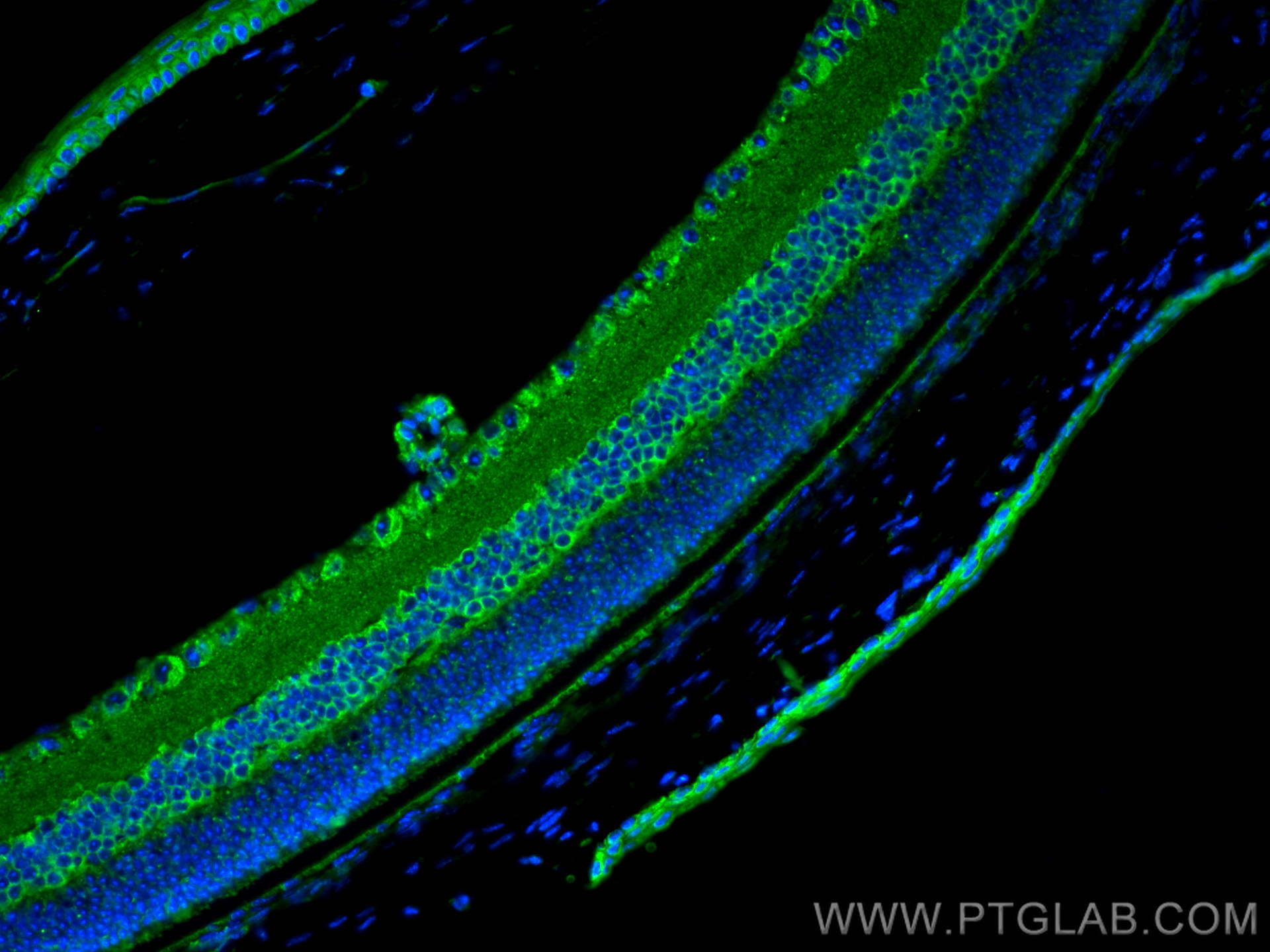 Immunofluorescence (IF) / fluorescent staining of mouse eye tissue using BST2 Polyclonal antibody (30118-1-AP)