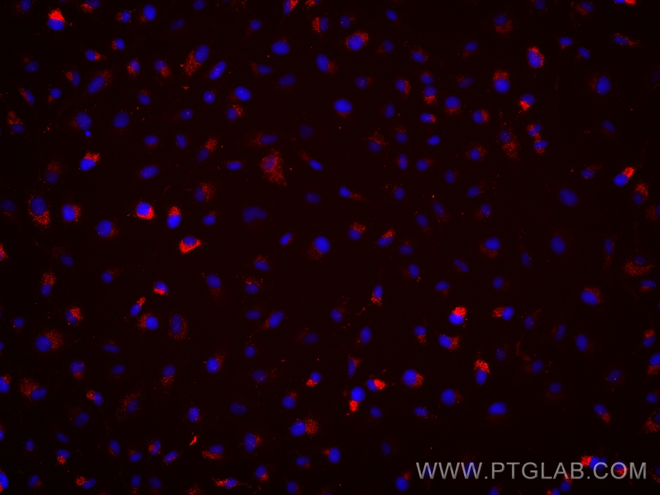 Immunofluorescence (IF) / fluorescent staining of HeLa cells using BST2 Monoclonal antibody (66919-1-Ig)