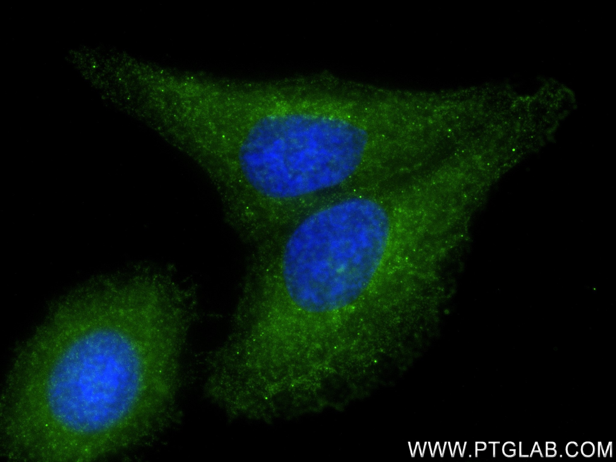 Immunofluorescence (IF) / fluorescent staining of HepG2 cells using BST2 Recombinant antibody (82733-7-RR)