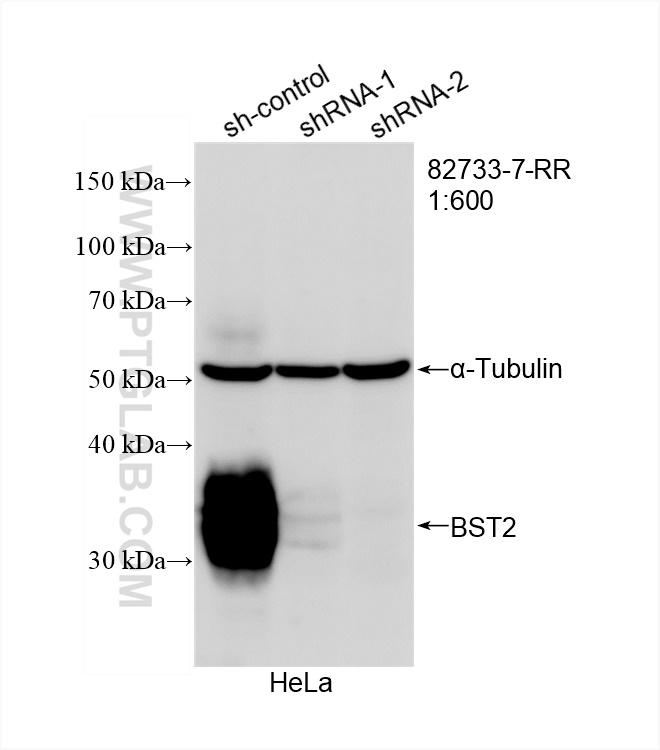 Western Blot (WB) analysis of HeLa cells using BST2 Recombinant antibody (82733-7-RR)