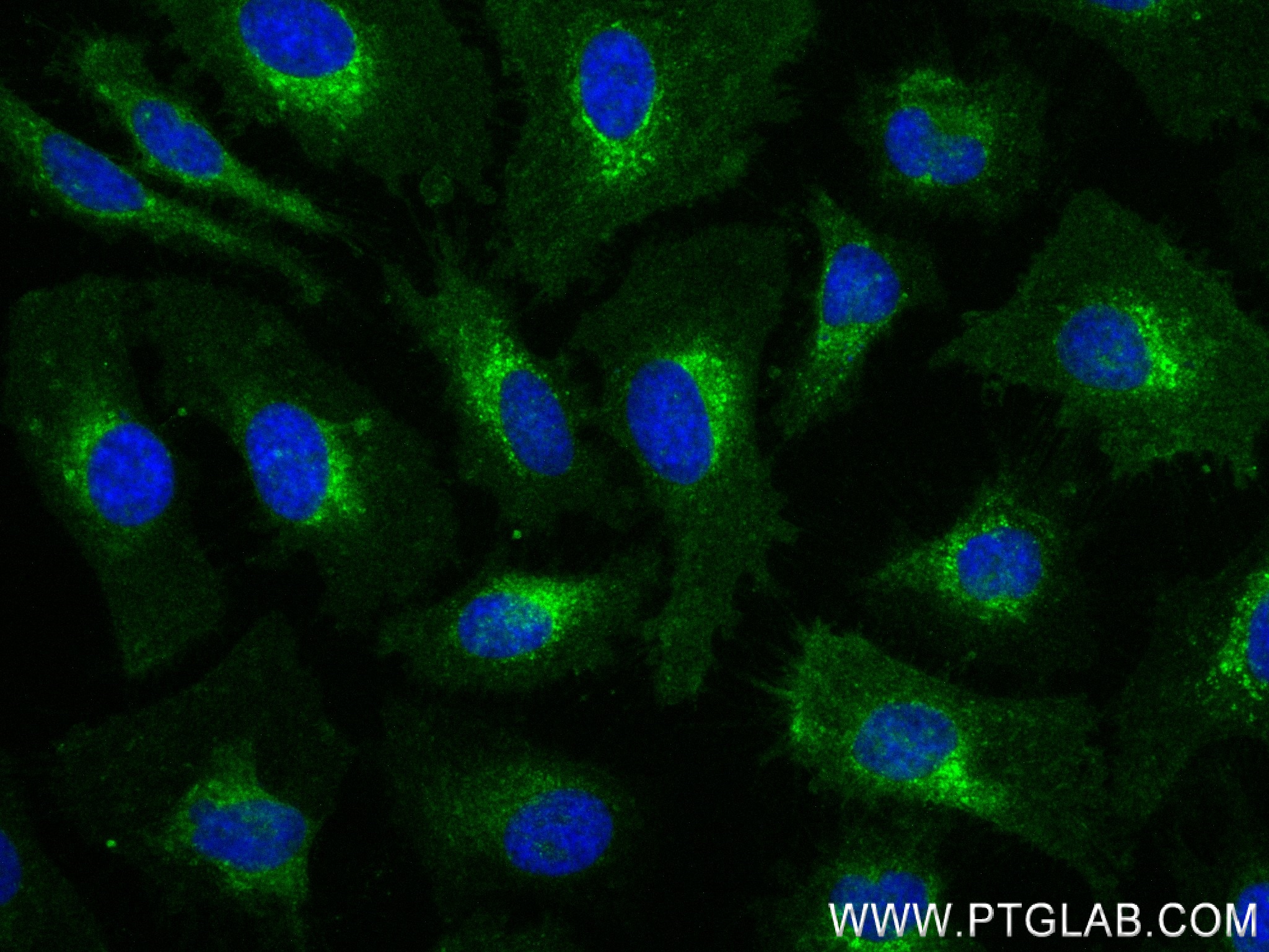 Immunofluorescence (IF) / fluorescent staining of HeLa cells using BST2 Recombinant antibody (84190-7-RR)