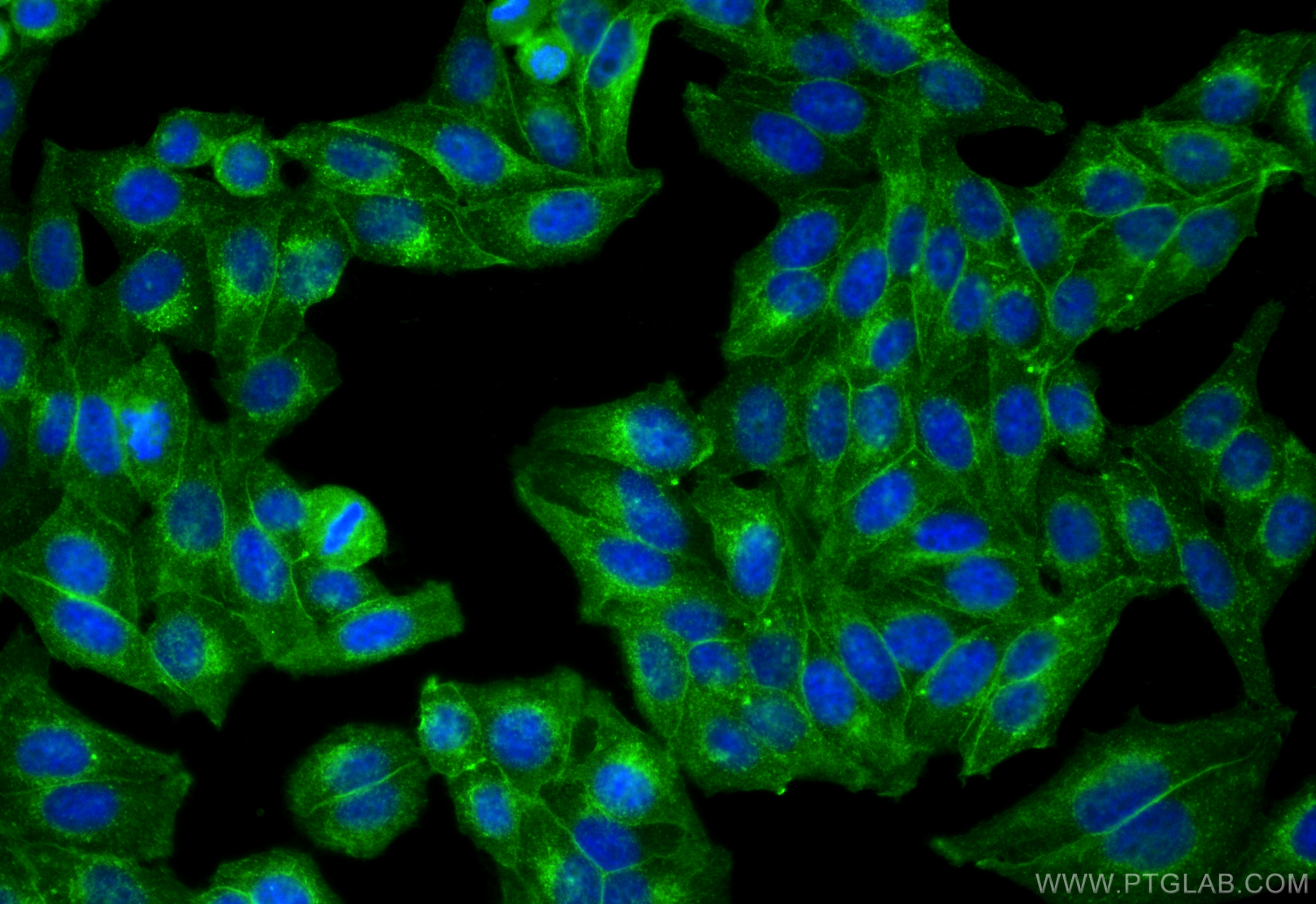 Immunofluorescence (IF) / fluorescent staining of HepG2 cells using BST2 Recombinant antibody (84190-7-RR)