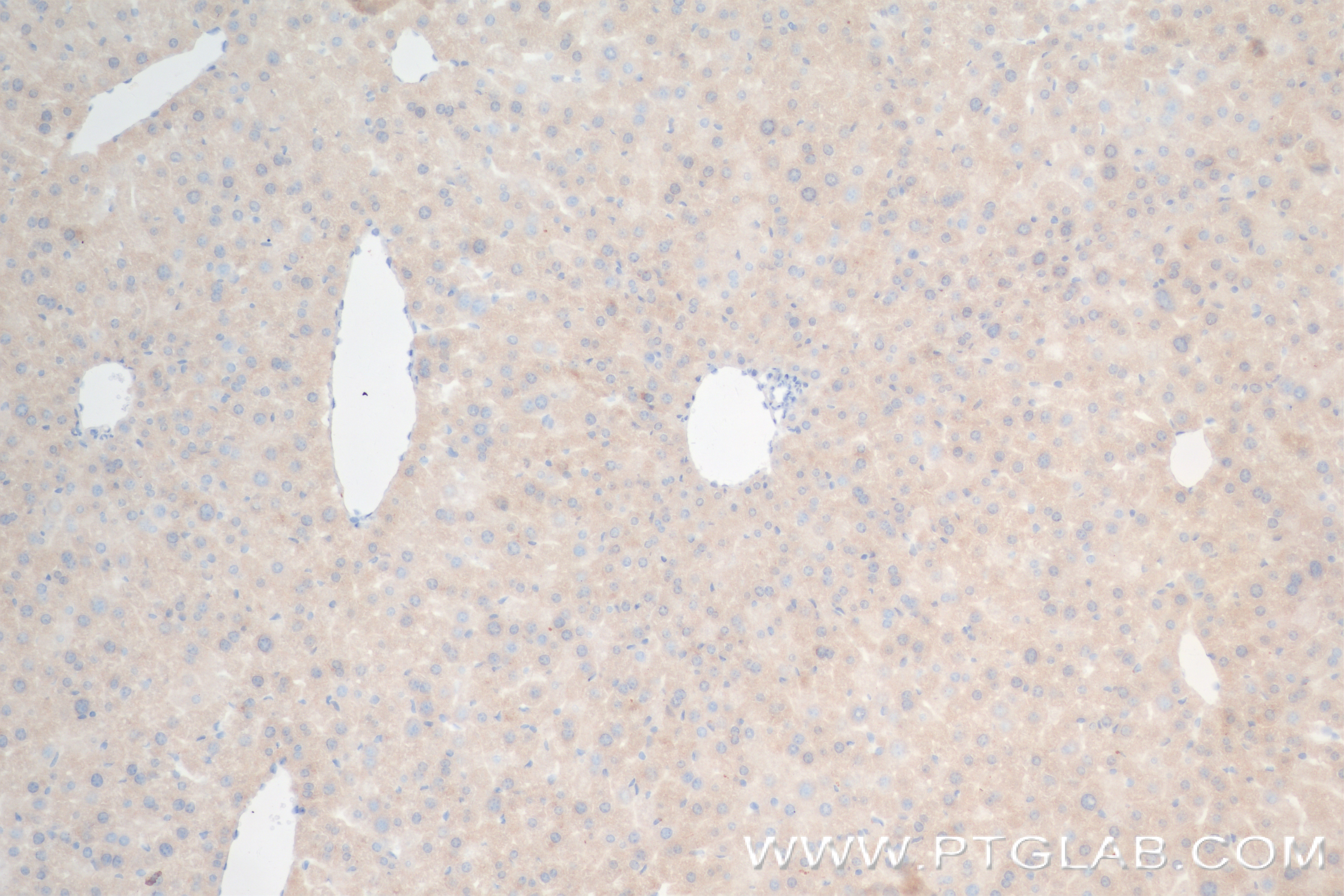 Immunohistochemistry (IHC) staining of mouse liver tissue using BST2 Recombinant antibody (84190-7-RR)