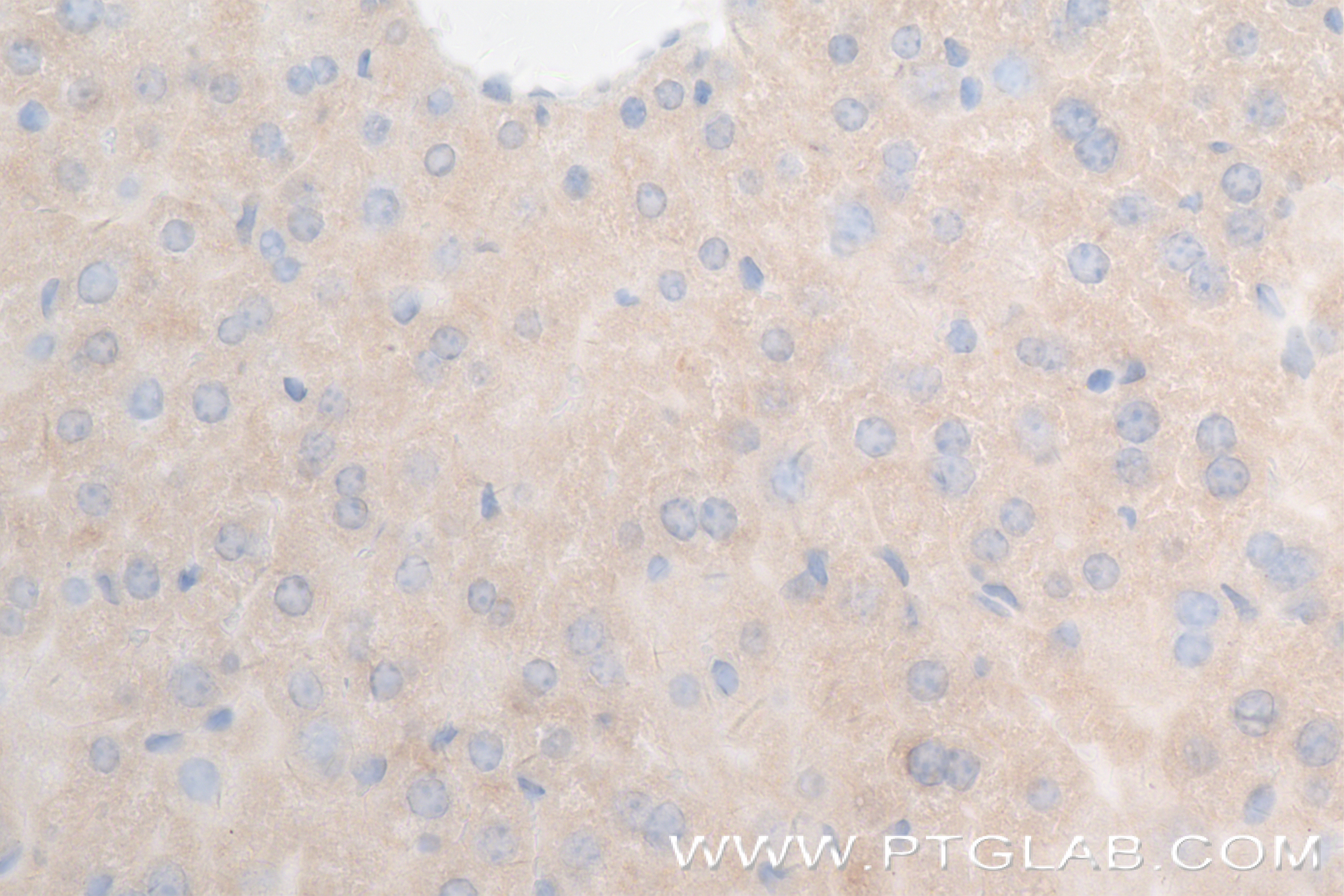 Immunohistochemistry (IHC) staining of mouse liver tissue using BST2 Recombinant antibody (84190-7-RR)