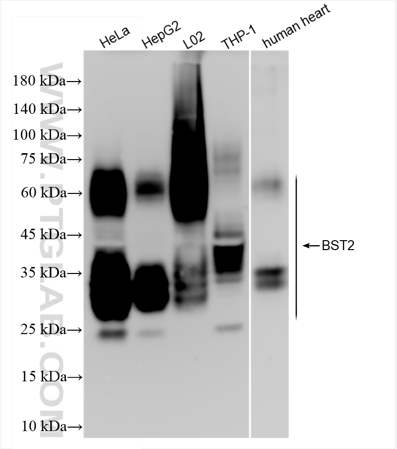 Western Blot (WB) analysis of various lysates using BST2 Recombinant antibody (84190-7-RR)