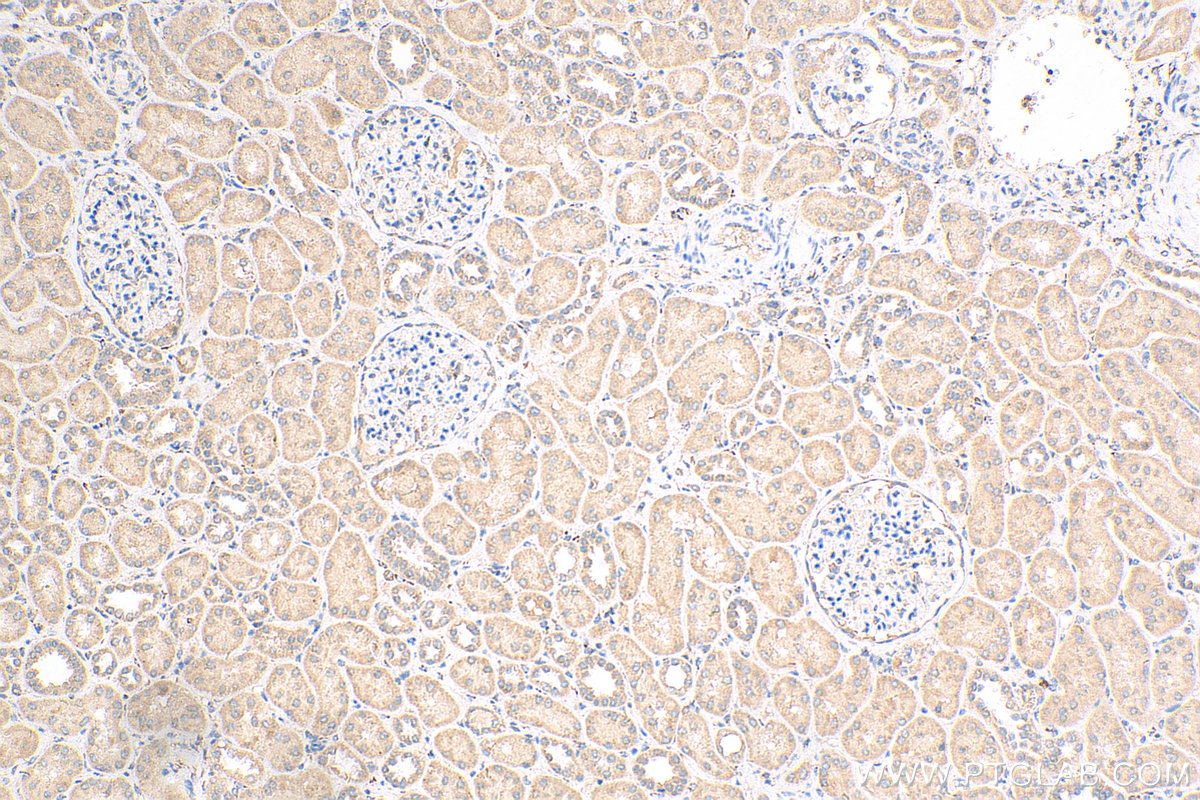 Immunohistochemistry (IHC) staining of human kidney tissue using BTBD16 Polyclonal antibody (24733-1-AP)