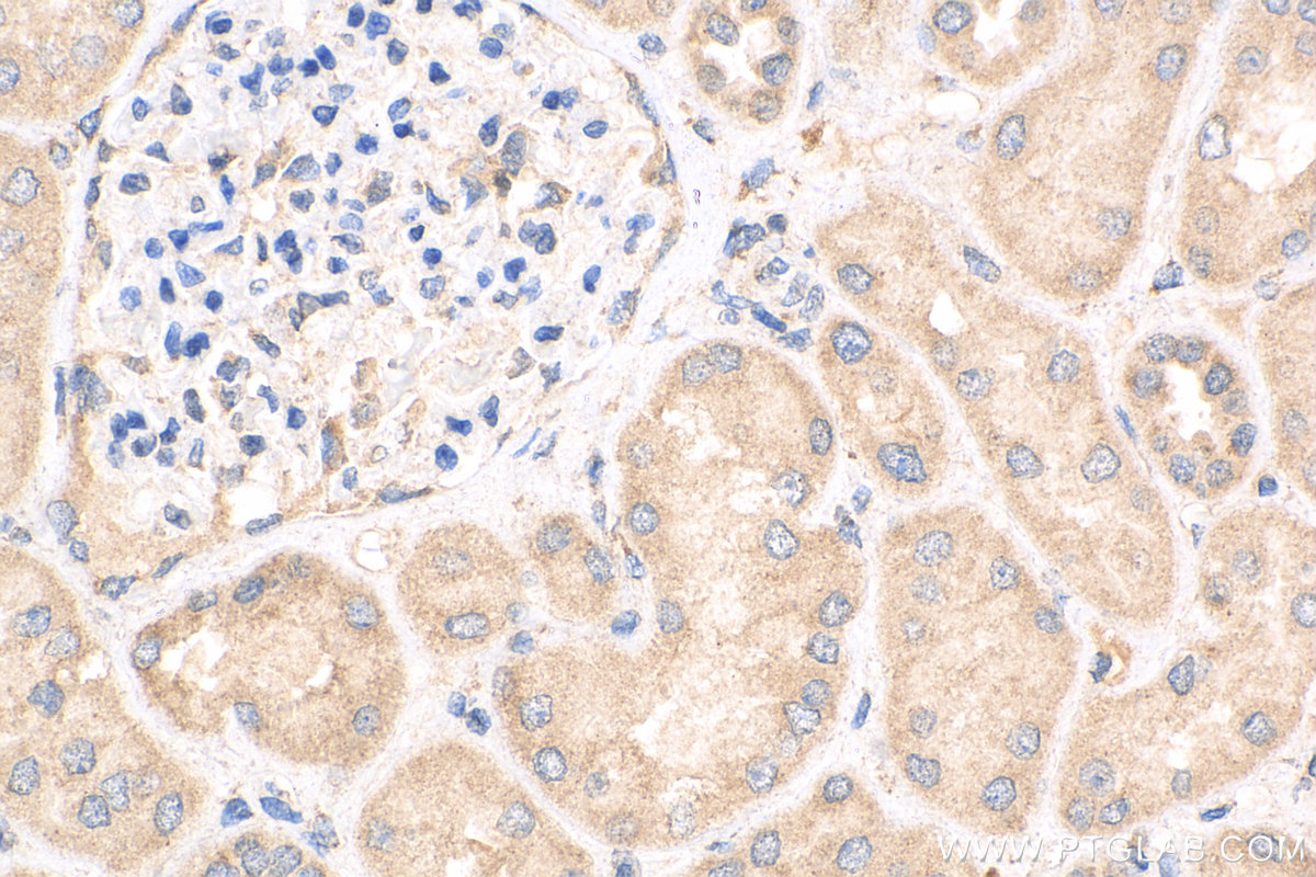 Immunohistochemistry (IHC) staining of human kidney tissue using BTBD16 Polyclonal antibody (24733-1-AP)