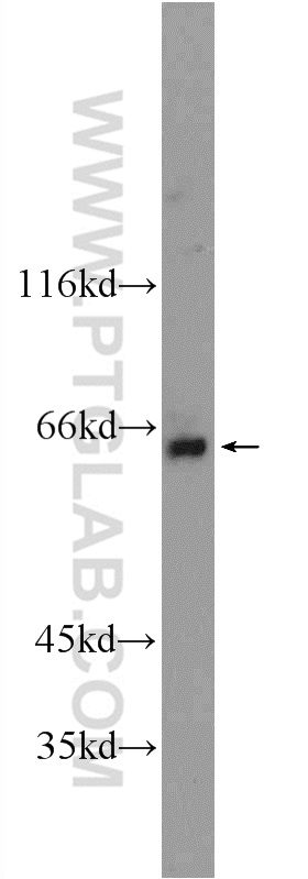 Western Blot (WB) analysis of mouse testis tissue using BTBD16 Polyclonal antibody (24733-1-AP)