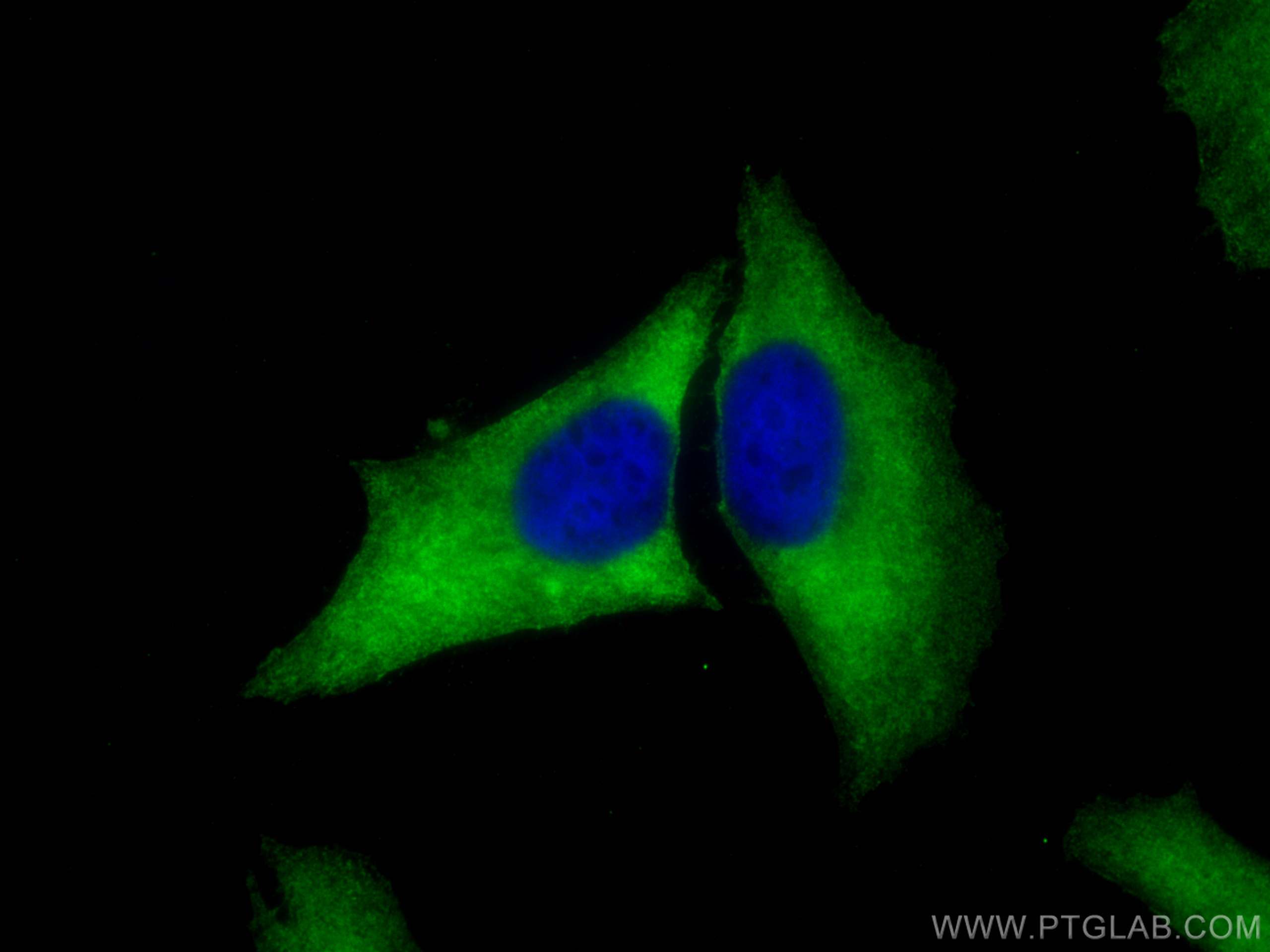 Immunofluorescence (IF) / fluorescent staining of HeLa cells using BTD Polyclonal antibody (16330-1-AP)