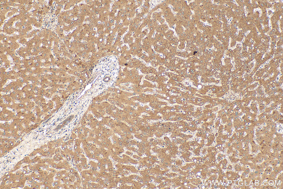 Immunohistochemistry (IHC) staining of human liver tissue using BTD Polyclonal antibody (16330-1-AP)