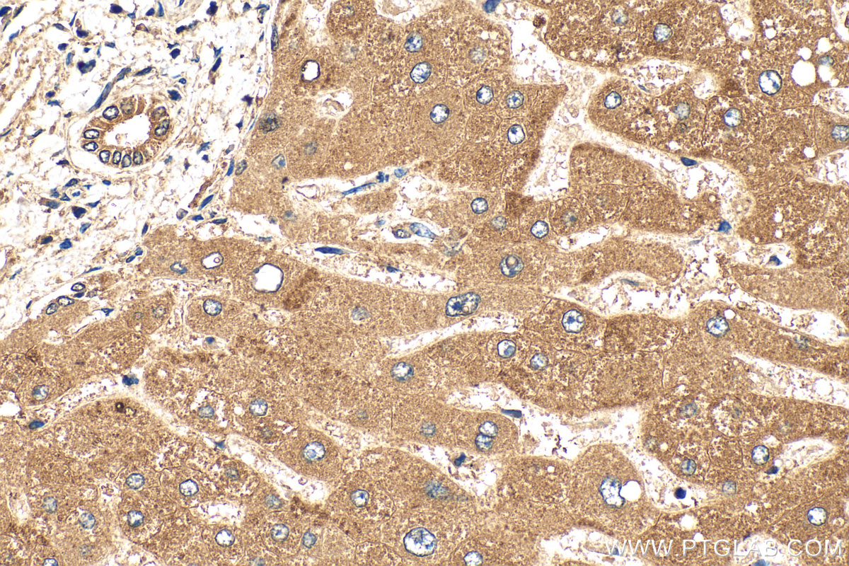 Immunohistochemistry (IHC) staining of human liver tissue using BTD Polyclonal antibody (16330-1-AP)