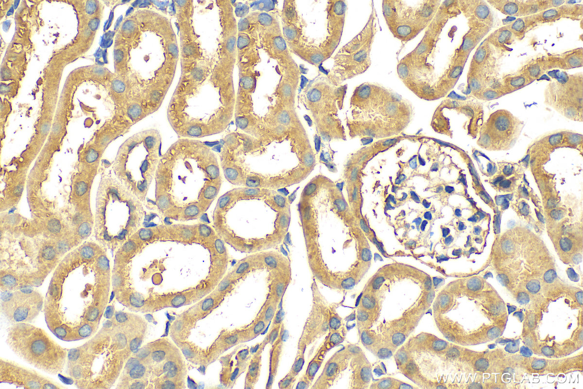 Immunohistochemistry (IHC) staining of mouse kidney tissue using BTD Polyclonal antibody (16330-1-AP)