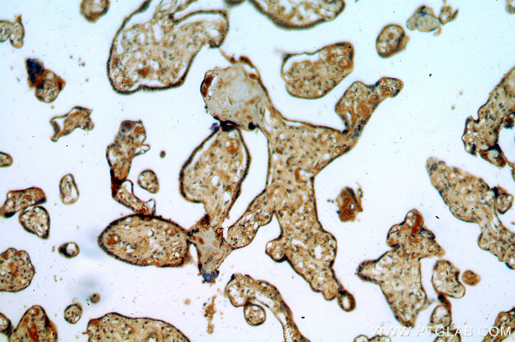 Immunohistochemistry (IHC) staining of human placenta tissue using BTF3L3-Specific Polyclonal antibody (19753-1-AP)