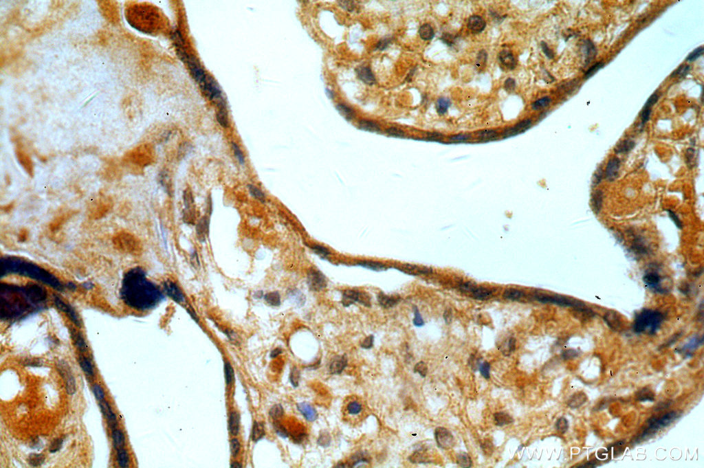 Immunohistochemistry (IHC) staining of human placenta tissue using BTF3L3-Specific Polyclonal antibody (19753-1-AP)