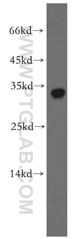 Western Blot (WB) analysis of human brain tissue using BTF3L3-Specific Polyclonal antibody (19753-1-AP)