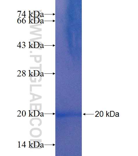 BTF3L4 fusion protein Ag9886 SDS-PAGE