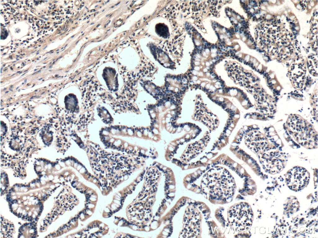 BTG2 antibody (22339-1-AP) | Proteintech