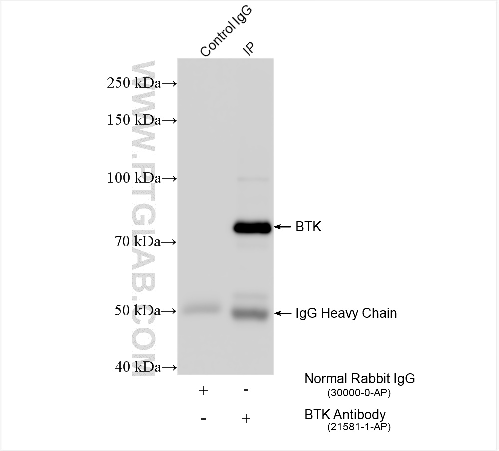 Immunoprecipitation (IP) experiment of mouse spleen tissue using BTK Polyclonal antibody (21581-1-AP)