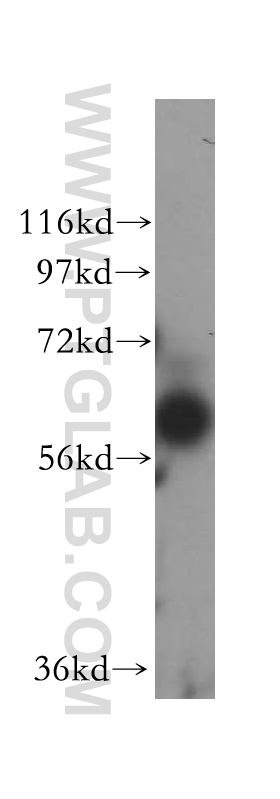 Western Blot (WB) analysis of MCF-7 cells using BTN2A2 Polyclonal antibody (16482-1-AP)