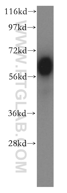 Western Blot (WB) analysis of human testis tissue using BTN2A2 Polyclonal antibody (16482-1-AP)