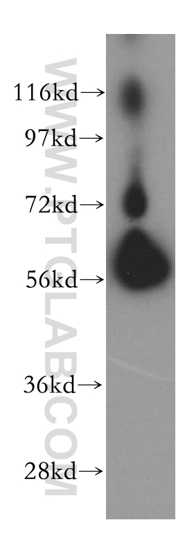 Western Blot (WB) analysis of NIH/3T3 cells using BTN2A2 Polyclonal antibody (16482-1-AP)