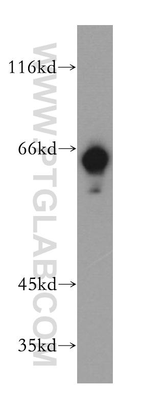 Western Blot (WB) analysis of Jurkat cells using BTN3A3 Polyclonal antibody (15896-1-AP)