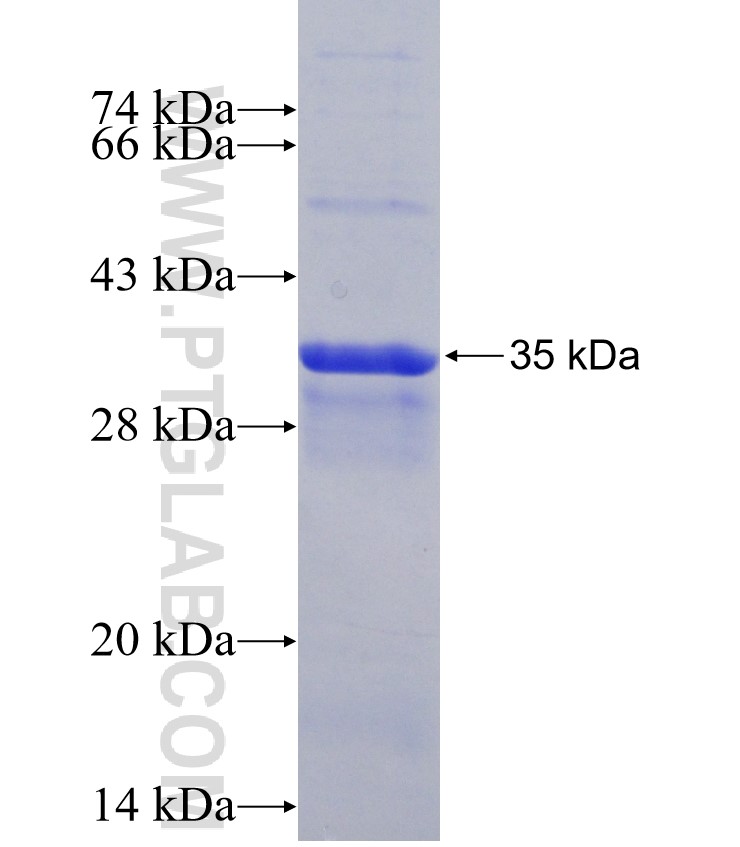 BTNL2 fusion protein Ag30307 SDS-PAGE