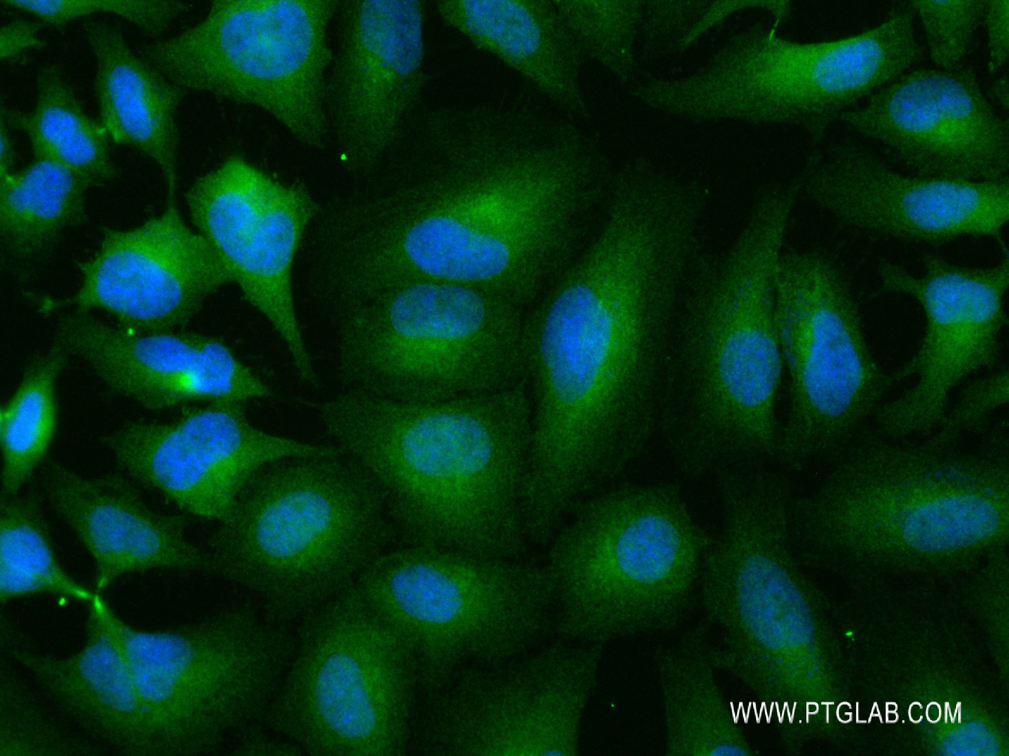 Immunofluorescence (IF) / fluorescent staining of HeLa cells using BUB1B Recombinant antibody (83920-6-RR)