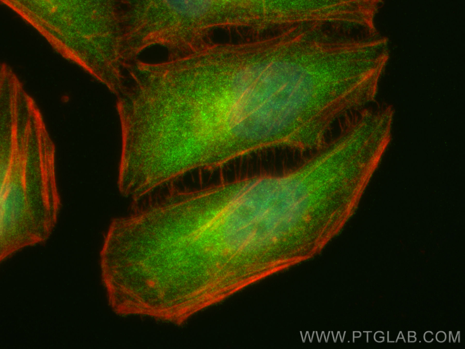 Immunofluorescence (IF) / fluorescent staining of HeLa cells using BUB1B Recombinant antibody (83920-6-RR)