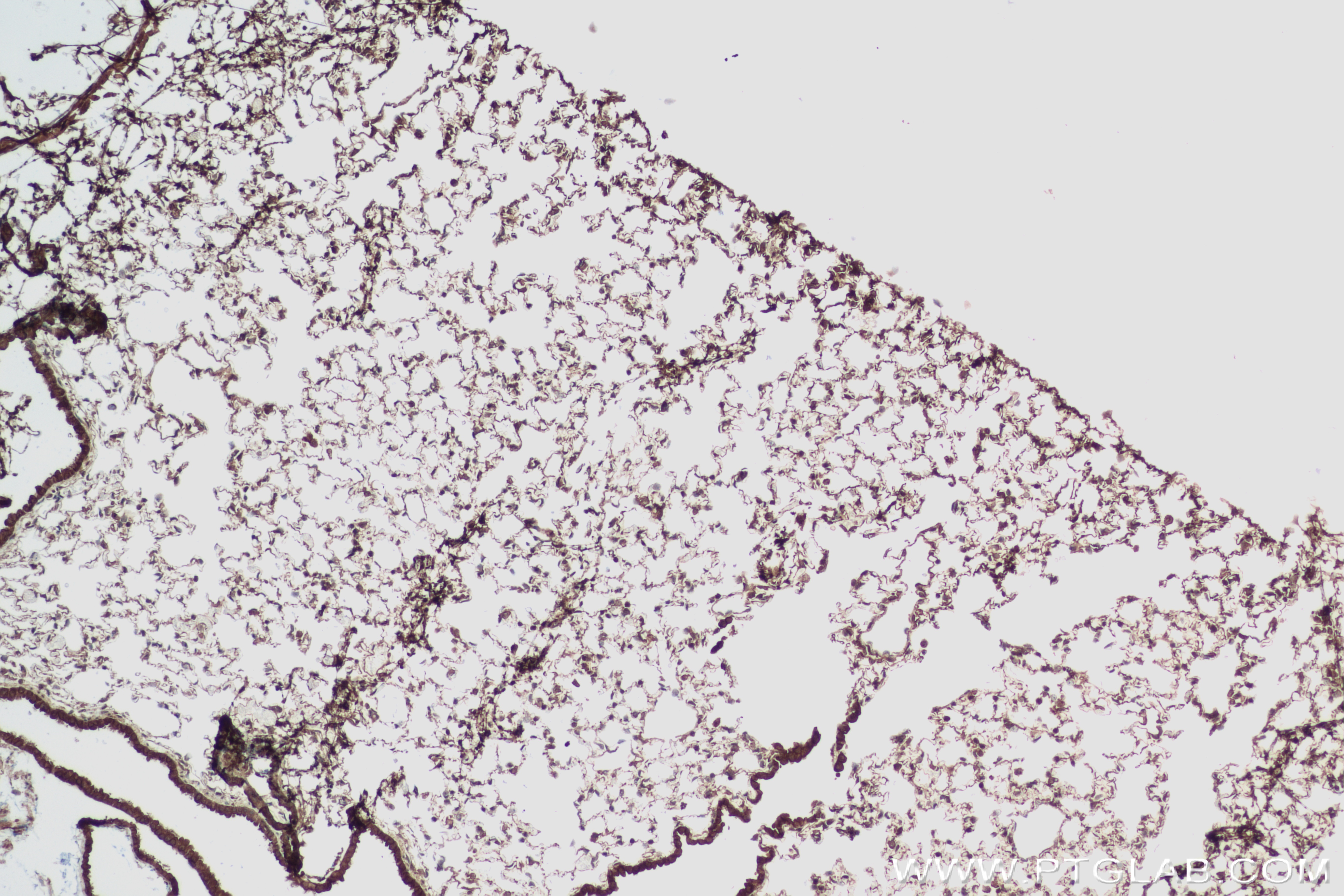 Immunohistochemistry (IHC) staining of mouse lung tissue using BUB1B Recombinant antibody (83920-6-RR)