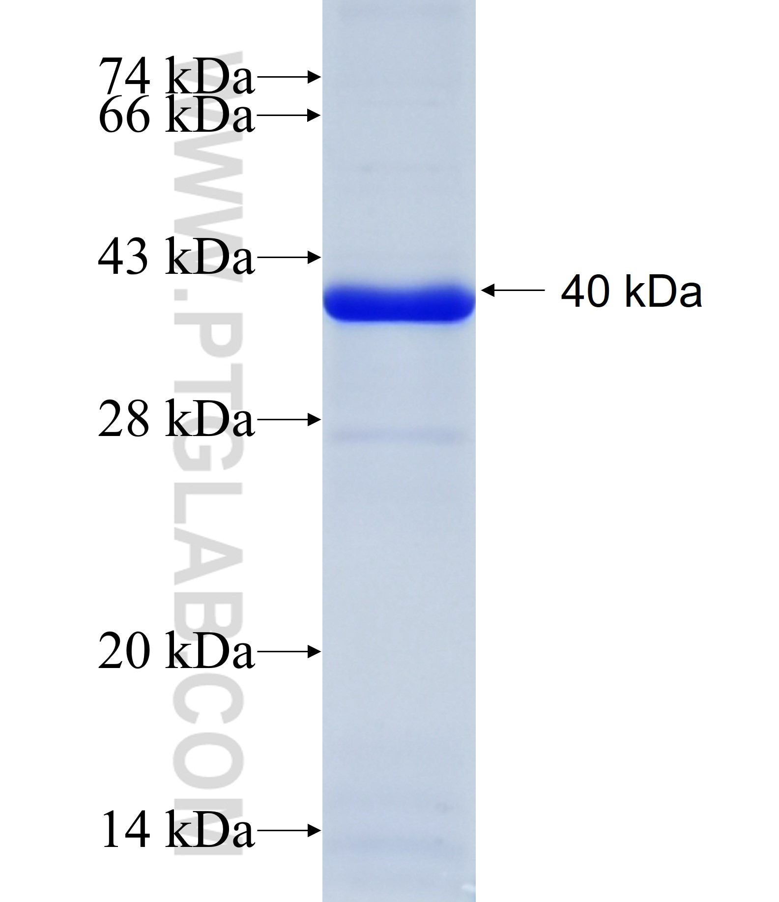 BUB1B fusion protein Ag34182 SDS-PAGE