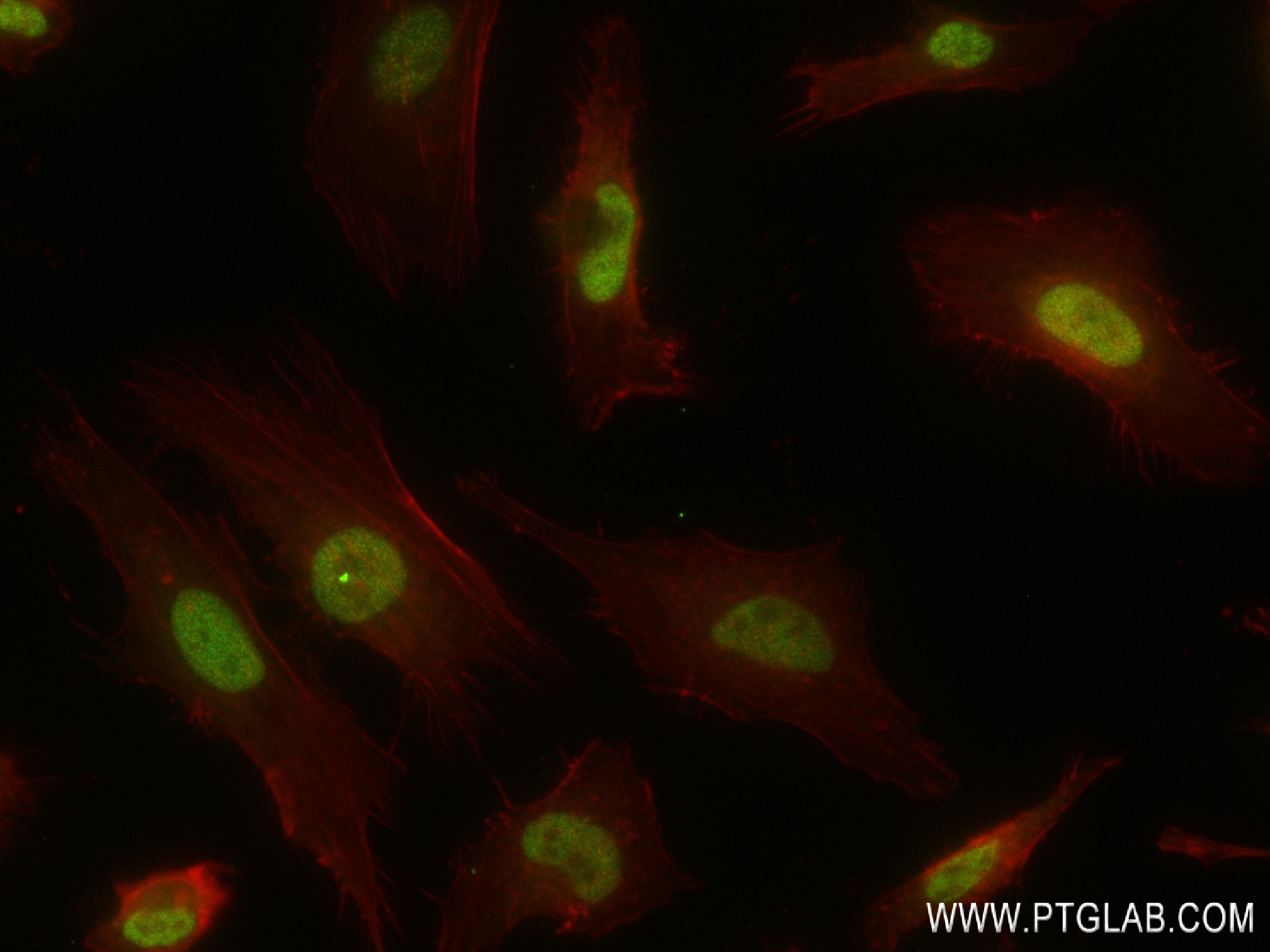 Immunofluorescence (IF) / fluorescent staining of HeLa cells using BUB3 Recombinant antibody (83266-5-RR)