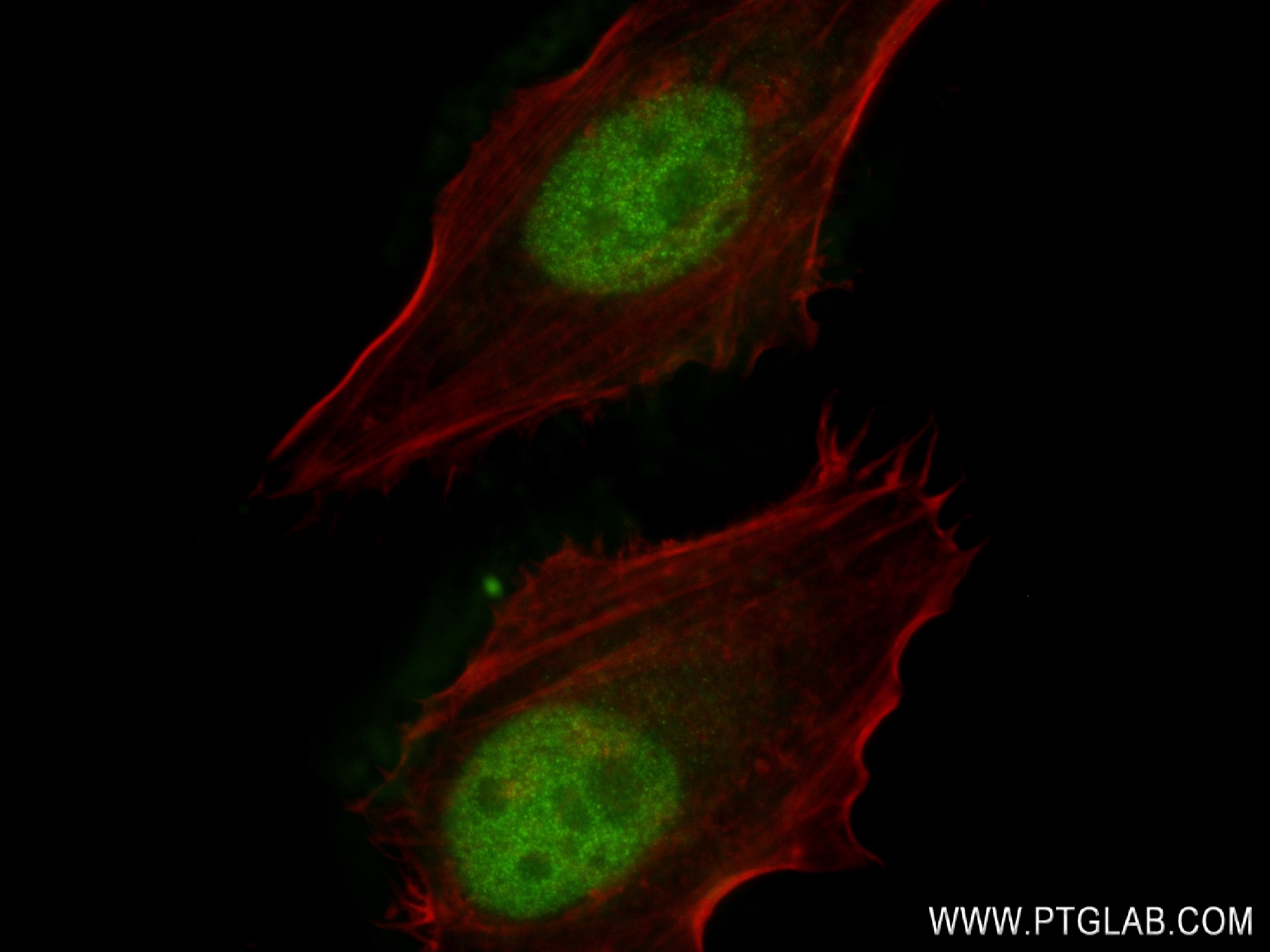 Immunofluorescence (IF) / fluorescent staining of HeLa cells using BUB3 Recombinant antibody (83266-5-RR)