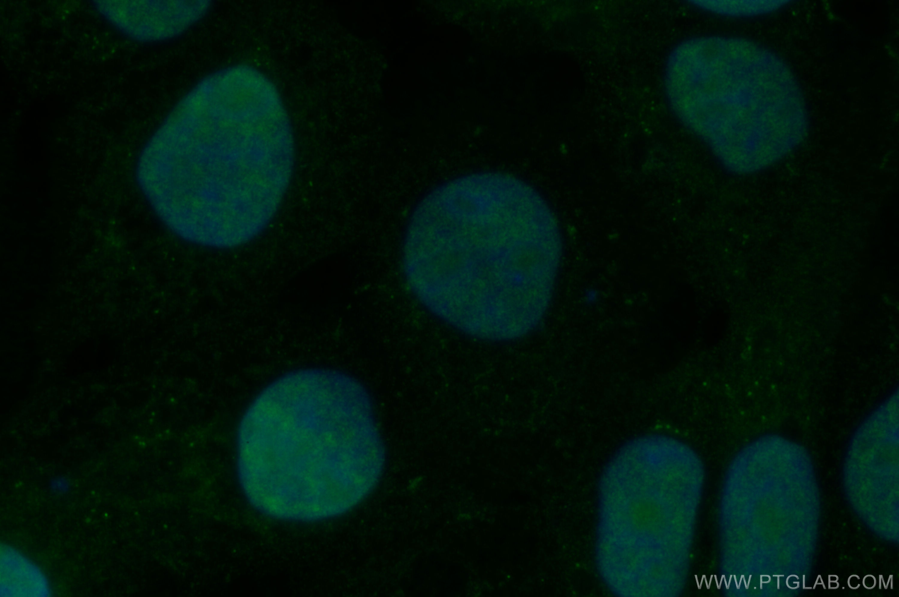 Immunofluorescence (IF) / fluorescent staining of A431 cells using BUD13 Polyclonal antibody (20163-1-AP)