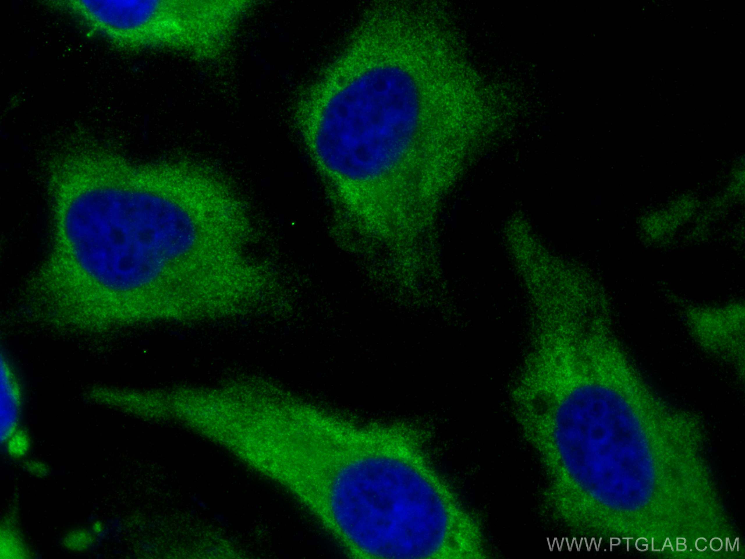 Immunofluorescence (IF) / fluorescent staining of HeLa cells using BZW1 Polyclonal antibody (19917-1-AP)