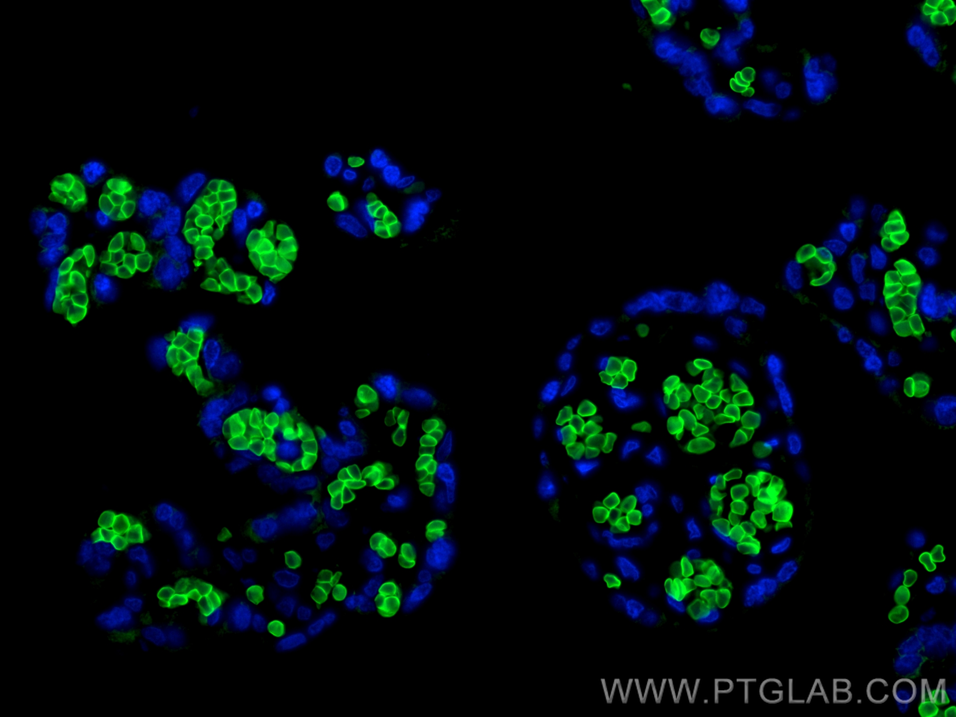 Immunofluorescence (IF) / fluorescent staining of human placenta tissue using CoraLite® Plus 488-conjugated Band 3/AE 1 Polyclon (CL488-28131)