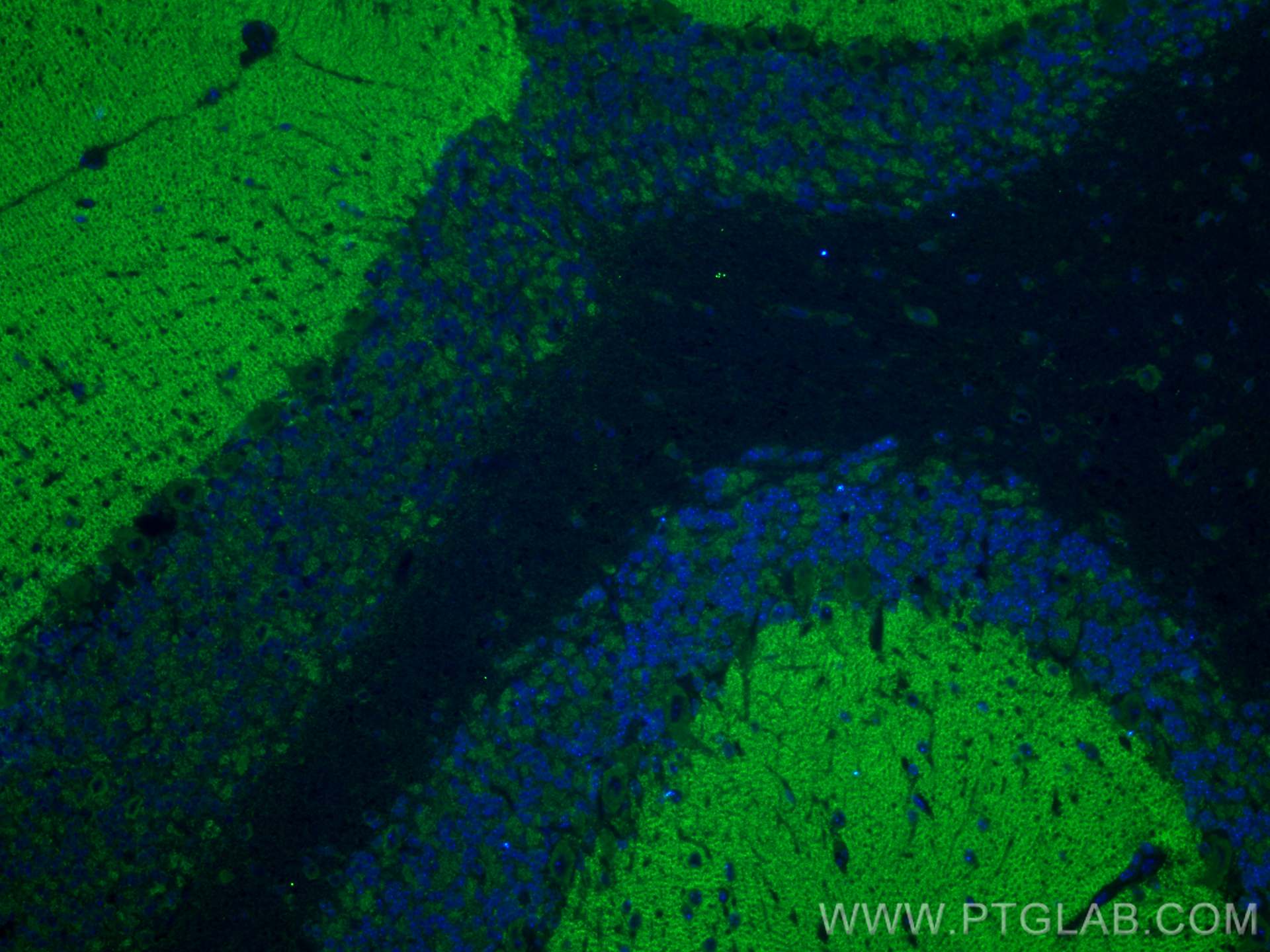 Immunofluorescence (IF) / fluorescent staining of mouse cerebellum tissue using Bassoon Polyclonal antibody (30392-1-AP)