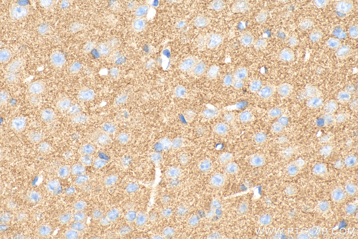 Immunohistochemistry (IHC) staining of mouse brain tissue using Bassoon Polyclonal antibody (30392-1-AP)